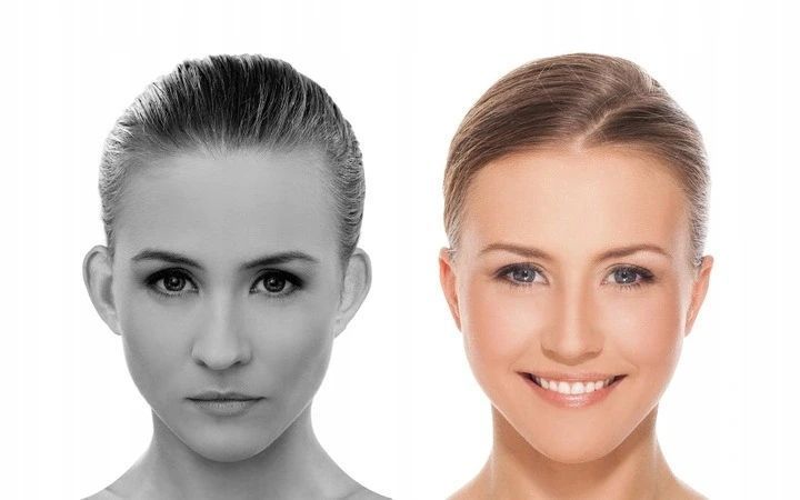 Otostick - Коректори естетичні для вух Otostick Aesthetic 8 шт 105093 фото