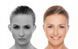 Otostick - Коректори естетичні для вух Otostick Aesthetic 8 шт 105093 фото 4