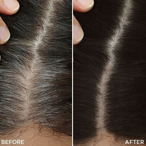 Toppik Hair Fattener -Препарат для потовщення волосся Toppik Hair Fattener 118 мл 105099 фото